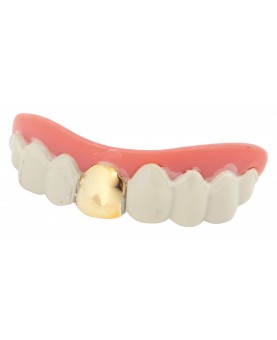 Dentier dent en or